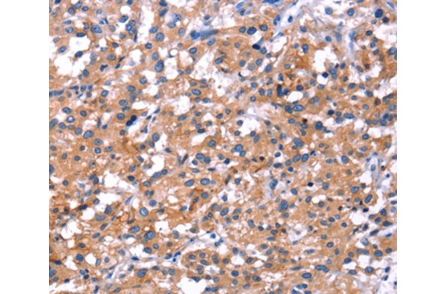 Immunohistochemistry - IRS1 Antibody from Signalway Antibody (35792) - Antibodies.com