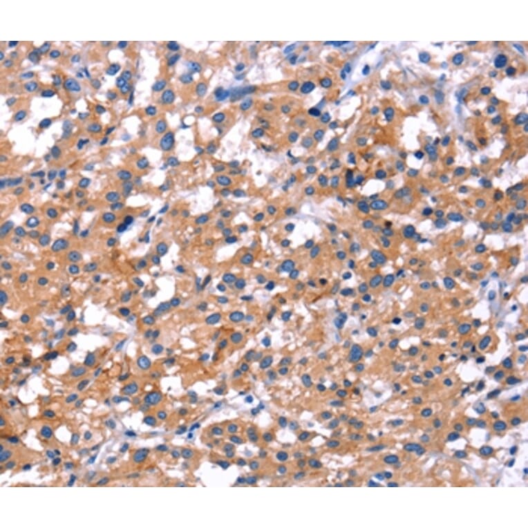 Immunohistochemistry - IRS1 Antibody from Signalway Antibody (35792) - Antibodies.com