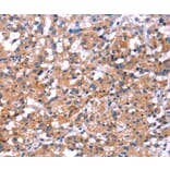 Immunohistochemistry - IRS1 Antibody from Signalway Antibody (35792) - Antibodies.com
