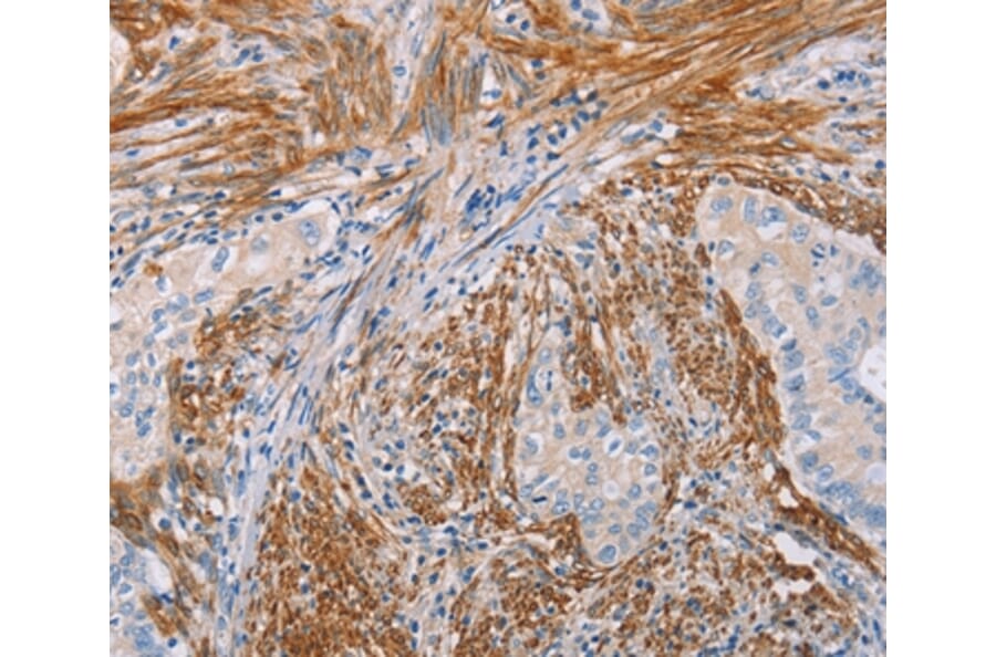 Immunohistochemistry - KLK4 Antibody from Signalway Antibody (35796) - Antibodies.com