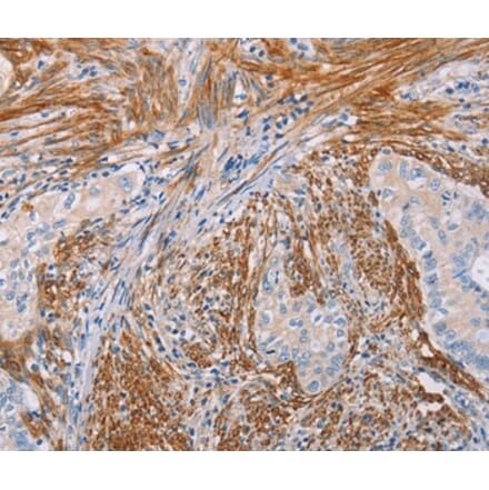 Immunohistochemistry - KLK4 Antibody from Signalway Antibody (35796) - Antibodies.com
