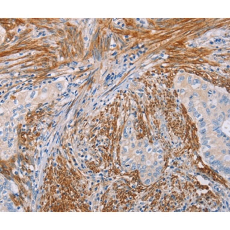 Immunohistochemistry - KLK4 Antibody from Signalway Antibody (35796) - Antibodies.com