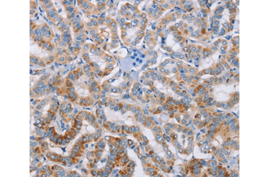 Immunohistochemistry - KLK4 Antibody from Signalway Antibody (35796) - Antibodies.com
