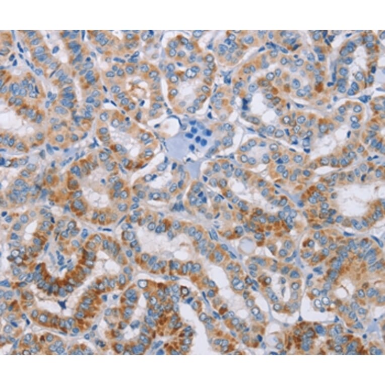 Immunohistochemistry - KLK4 Antibody from Signalway Antibody (35796) - Antibodies.com