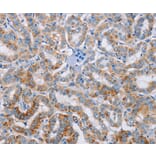 Immunohistochemistry - KLK4 Antibody from Signalway Antibody (35796) - Antibodies.com