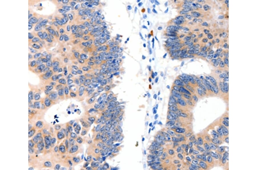 Immunohistochemistry - LAT2 Antibody from Signalway Antibody (35799) - Antibodies.com