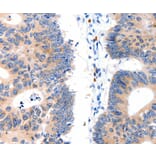 Immunohistochemistry - LAT2 Antibody from Signalway Antibody (35799) - Antibodies.com