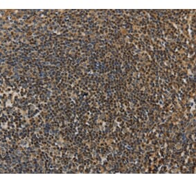 Immunohistochemistry - LEF1 Antibody from Signalway Antibody (35801) - Antibodies.com