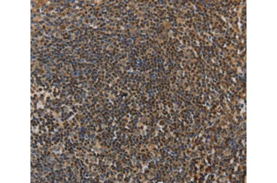 Immunohistochemistry - LEF1 Antibody from Signalway Antibody (35801) - Antibodies.com