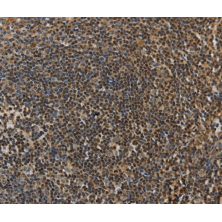 Immunohistochemistry - LEF1 Antibody from Signalway Antibody (35801) - Antibodies.com