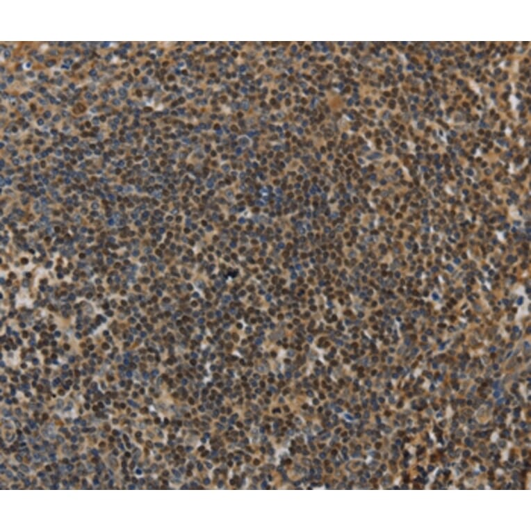 Immunohistochemistry - LEF1 Antibody from Signalway Antibody (35801) - Antibodies.com