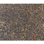 Immunohistochemistry - LEF1 Antibody from Signalway Antibody (35801) - Antibodies.com