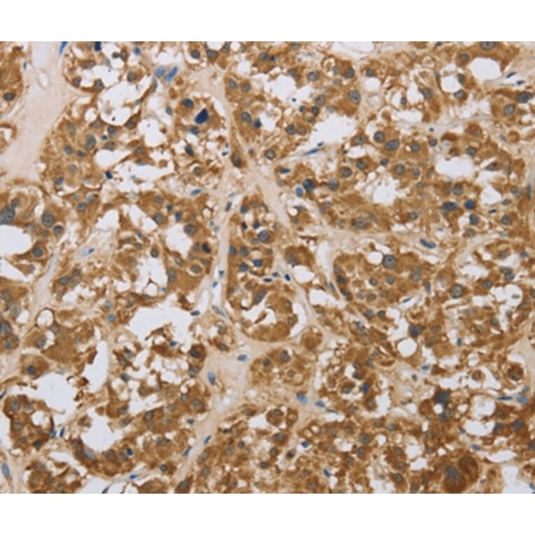 Immunohistochemistry - LEF1 Antibody from Signalway Antibody (35801) - Antibodies.com
