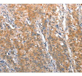 Immunohistochemistry - ST14 Antibody from Signalway Antibody (35811) - Antibodies.com