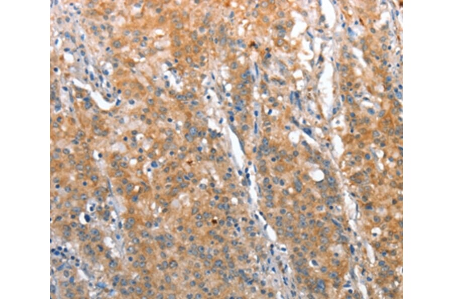 Immunohistochemistry - ST14 Antibody from Signalway Antibody (35811) - Antibodies.com