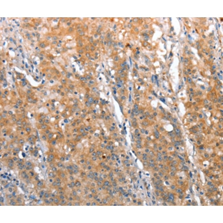Immunohistochemistry - ST14 Antibody from Signalway Antibody (35811) - Antibodies.com