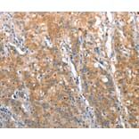 Immunohistochemistry - ST14 Antibody from Signalway Antibody (35811) - Antibodies.com