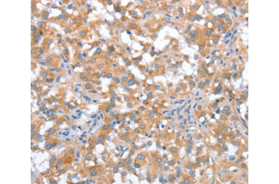 Immunohistochemistry - ST14 Antibody from Signalway Antibody (35811) - Antibodies.com