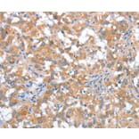 Immunohistochemistry - ST14 Antibody from Signalway Antibody (35811) - Antibodies.com