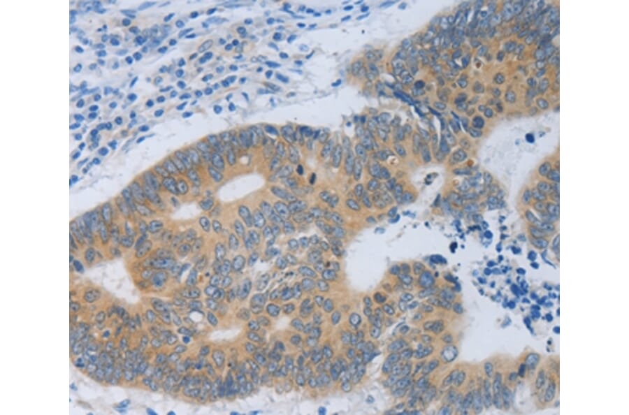 Immunohistochemistry - MT2A Antibody from Signalway Antibody (35814) - Antibodies.com