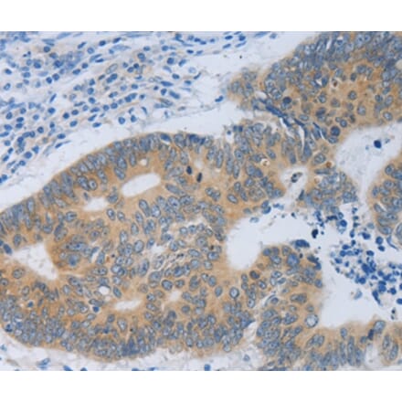 Immunohistochemistry - MT2A Antibody from Signalway Antibody (35814) - Antibodies.com