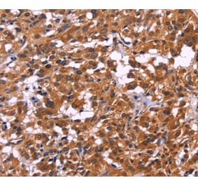 Immunohistochemistry - MSH4 Antibody from Signalway Antibody (35821) - Antibodies.com