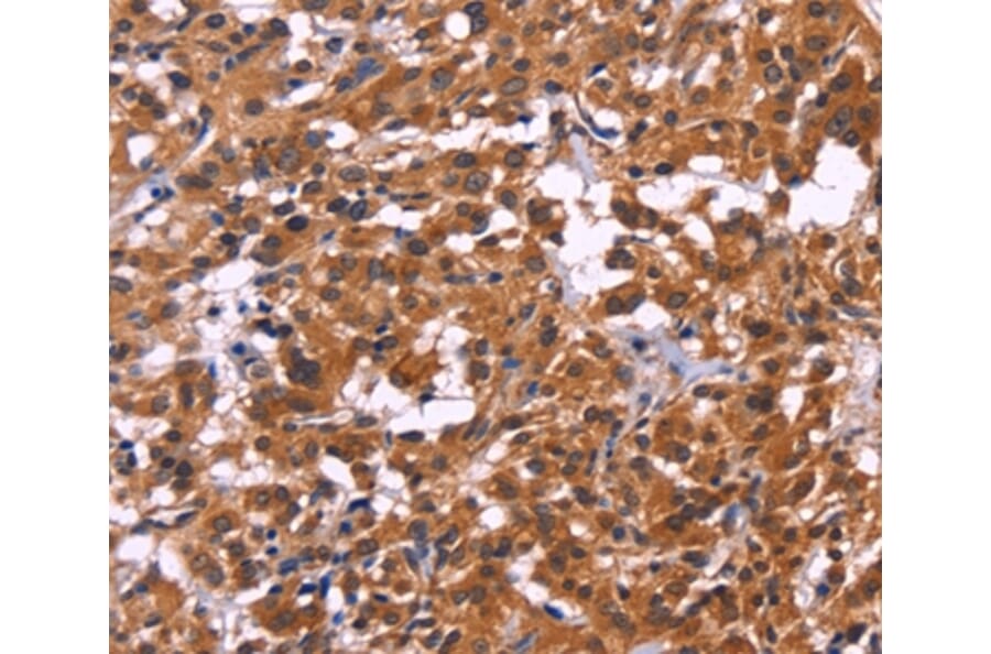 Immunohistochemistry - MSH4 Antibody from Signalway Antibody (35821) - Antibodies.com