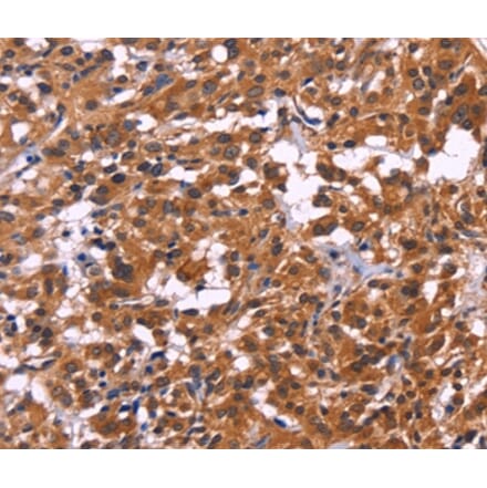 Immunohistochemistry - MSH4 Antibody from Signalway Antibody (35821) - Antibodies.com