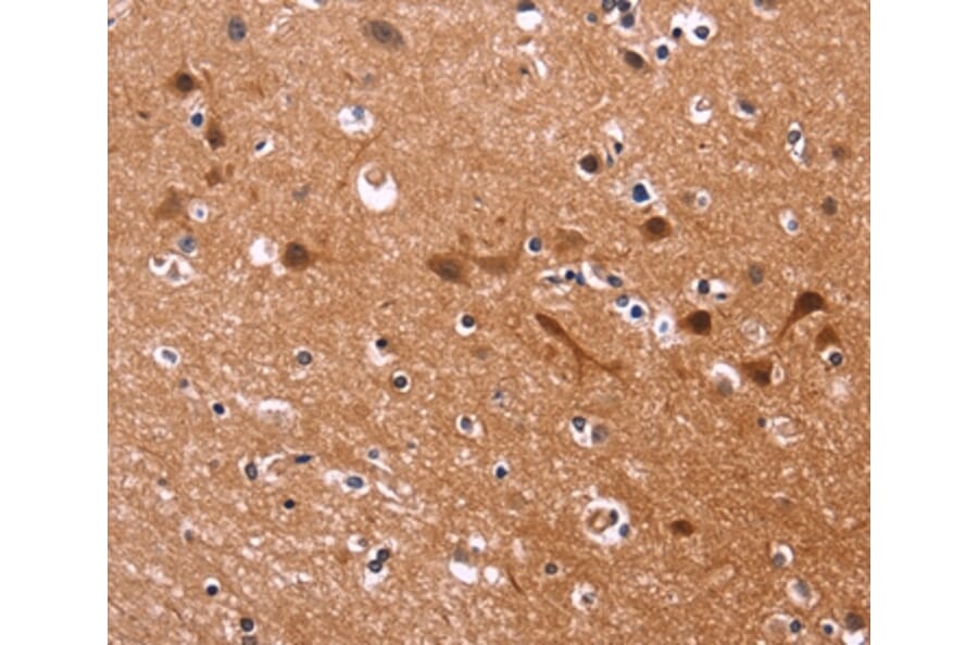 Immunohistochemistry - MSH4 Antibody from Signalway Antibody (35821) - Antibodies.com