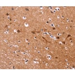 Immunohistochemistry - MSH4 Antibody from Signalway Antibody (35821) - Antibodies.com