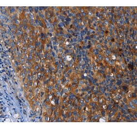 Immunohistochemistry - MSLN Antibody from Signalway Antibody (35823) - Antibodies.com