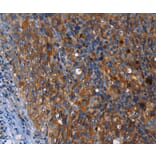 Immunohistochemistry - MSLN Antibody from Signalway Antibody (35823) - Antibodies.com