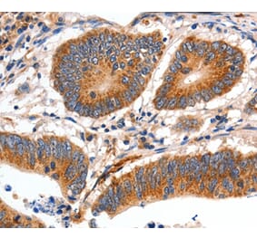 Immunohistochemistry - MYH7 Antibody from Signalway Antibody (35827) - Antibodies.com