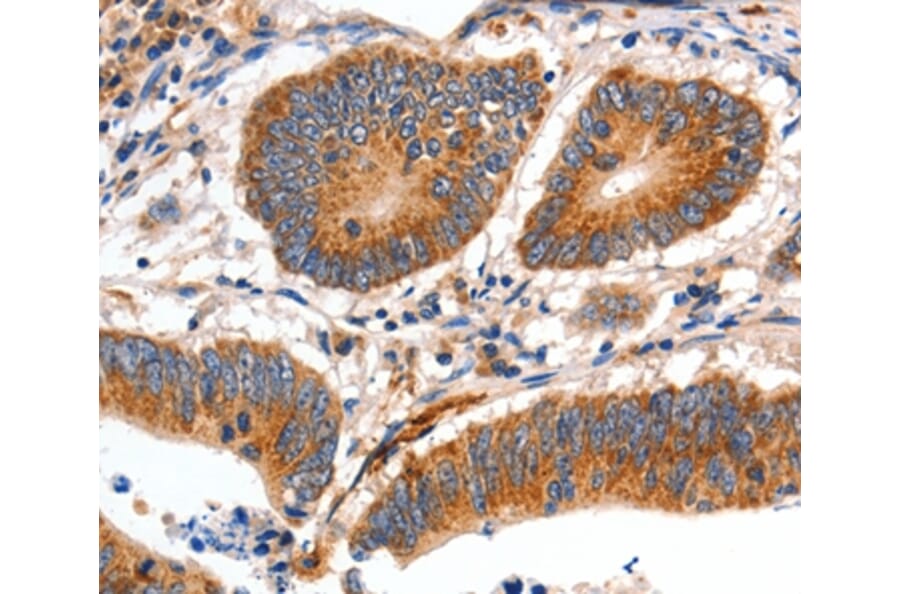 Immunohistochemistry - MYH7 Antibody from Signalway Antibody (35827) - Antibodies.com