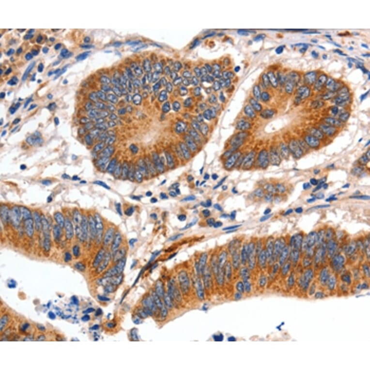 Immunohistochemistry - MYH7 Antibody from Signalway Antibody (35827) - Antibodies.com