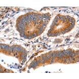 Immunohistochemistry - MYH7 Antibody from Signalway Antibody (35827) - Antibodies.com