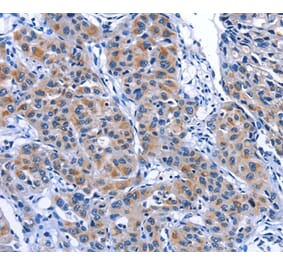 Immunohistochemistry - MYH1 Antibody from Signalway Antibody (35828) - Antibodies.com