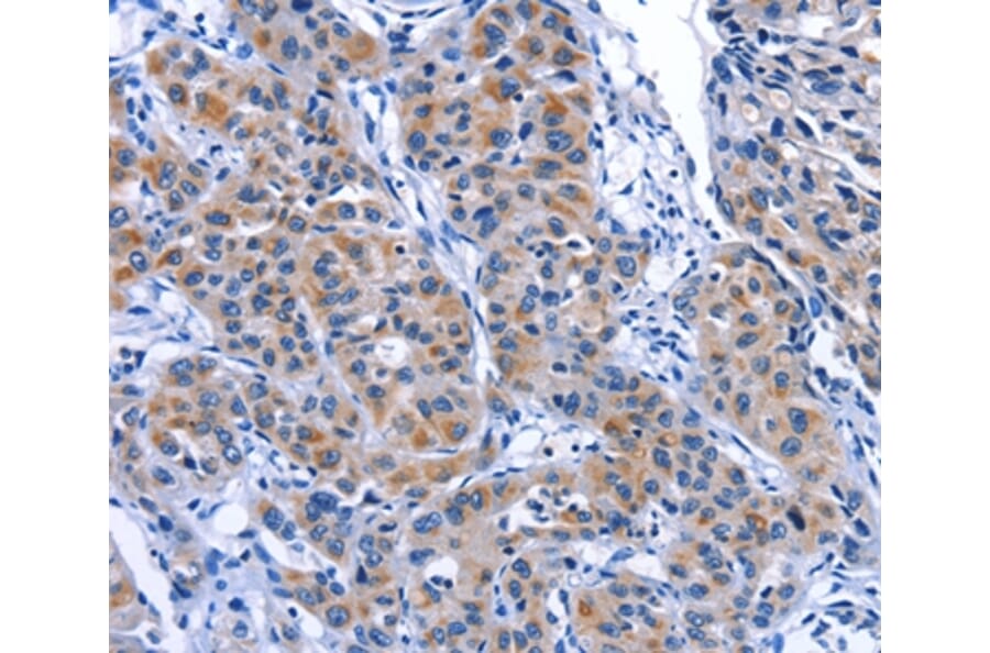 Immunohistochemistry - MYH1 Antibody from Signalway Antibody (35828) - Antibodies.com