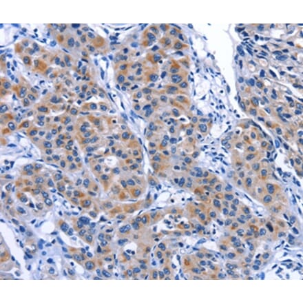 Immunohistochemistry - MYH1 Antibody from Signalway Antibody (35828) - Antibodies.com