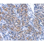 Immunohistochemistry - MYH1 Antibody from Signalway Antibody (35828) - Antibodies.com