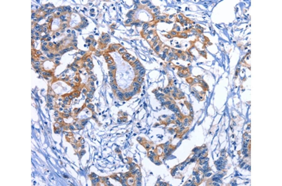 Immunohistochemistry - MYH1 Antibody from Signalway Antibody (35828) - Antibodies.com