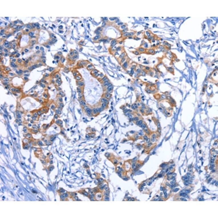 Immunohistochemistry - MYH1 Antibody from Signalway Antibody (35828) - Antibodies.com