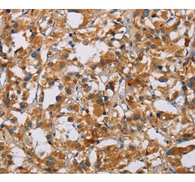 Immunohistochemistry - NRN1 Antibody from Signalway Antibody (35833) - Antibodies.com