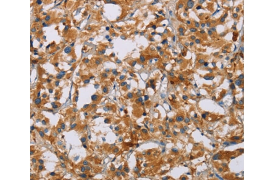 Immunohistochemistry - NRN1 Antibody from Signalway Antibody (35833) - Antibodies.com