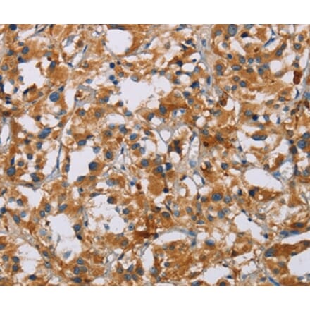 Immunohistochemistry - NRN1 Antibody from Signalway Antibody (35833) - Antibodies.com