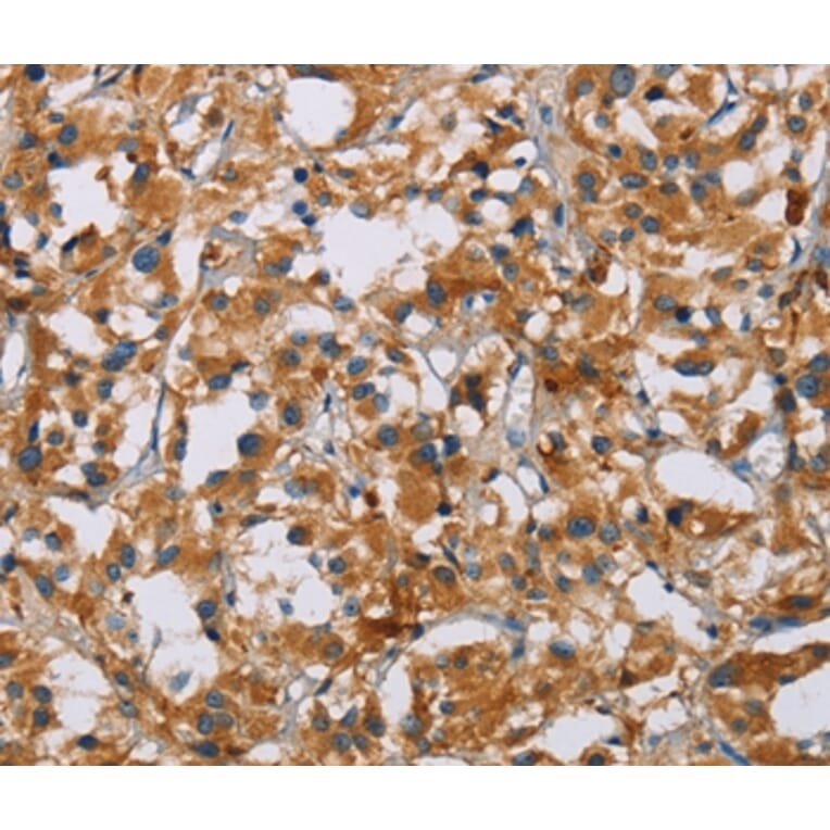 Immunohistochemistry - NRN1 Antibody from Signalway Antibody (35833) - Antibodies.com