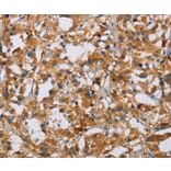 Immunohistochemistry - NRN1 Antibody from Signalway Antibody (35833) - Antibodies.com