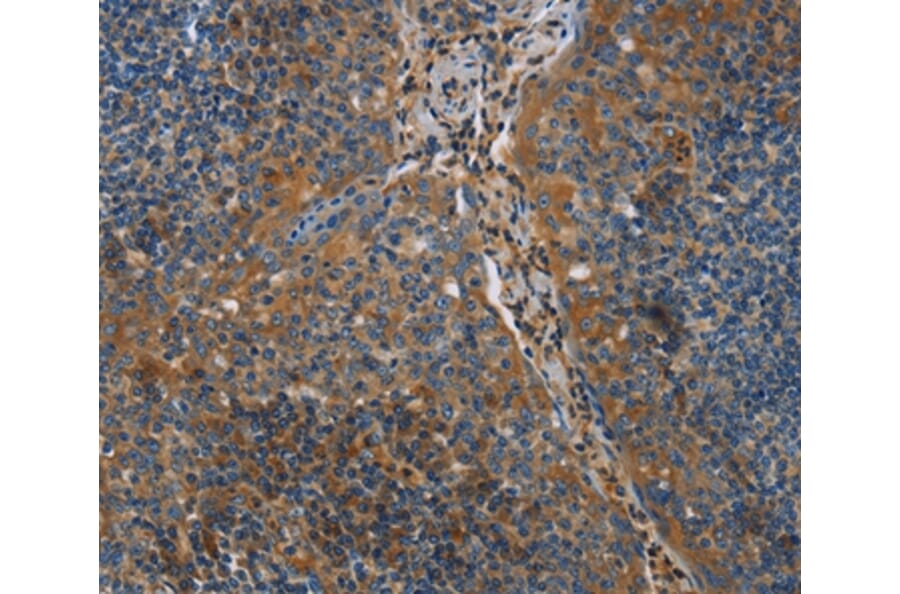 Immunohistochemistry - NRN1 Antibody from Signalway Antibody (35833) - Antibodies.com