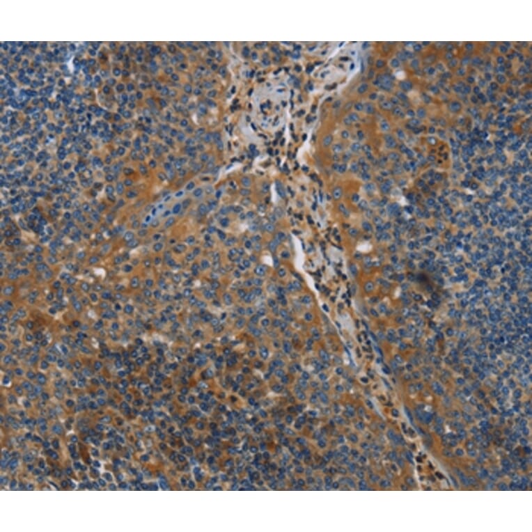 Immunohistochemistry - NRN1 Antibody from Signalway Antibody (35833) - Antibodies.com