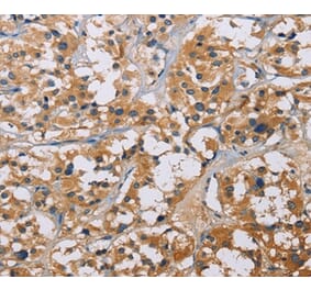 Immunohistochemistry - NME5 Antibody from Signalway Antibody (35842) - Antibodies.com